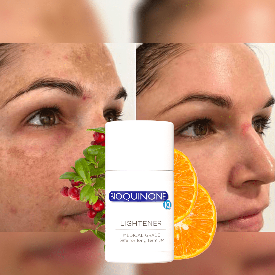 Bioquinone - zenmedispa