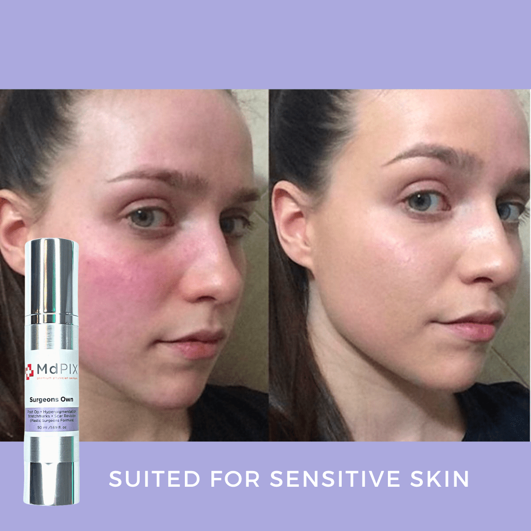 Md PIX Surgeons Own (50ml) - zenmedispa