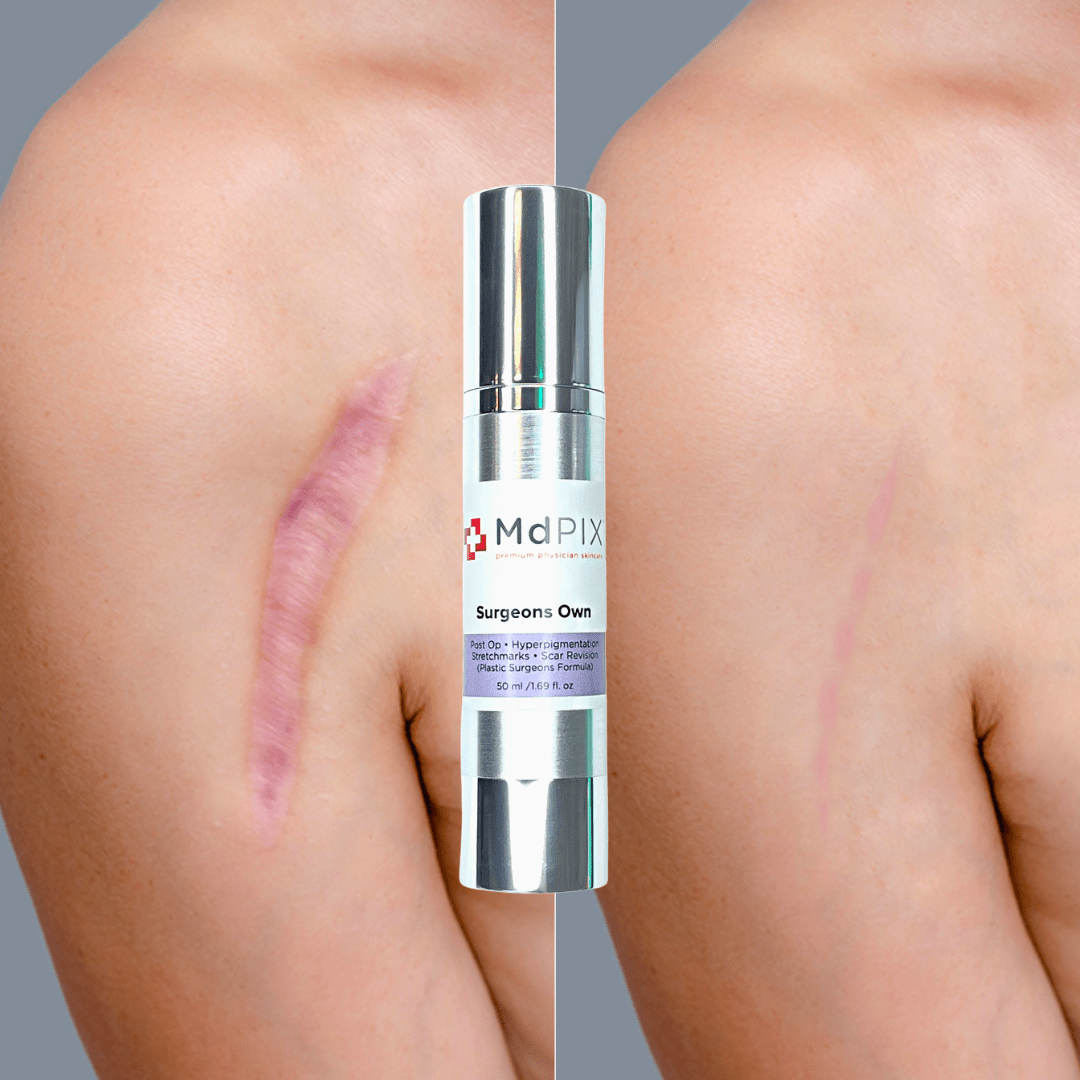 Md PIX Surgeons Own (50ml) - zenmedispa