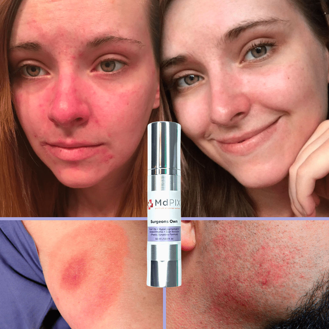 Md PIX Surgeons Own (50ml) - zenmedispa