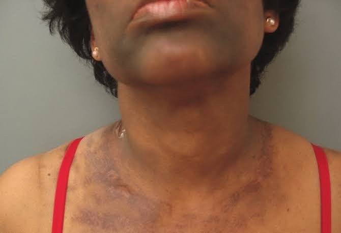 SA 🇿🇦 - Nano Blanc Skin Corrector (30g) FACE & BODY USE - zenmedispa